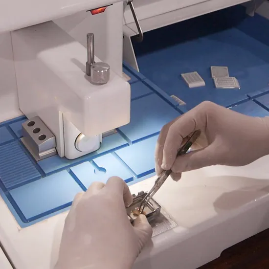 Incorporação de centros de incorporação Máquina Máquina X RAY Audiômetro Audiômetro Blood Glicose Monitor Monitor Portátil Analyze Centers de incorporação